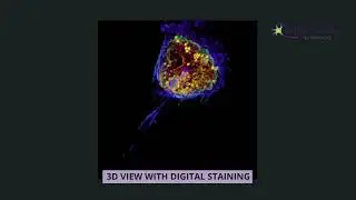 Programmed cell death apoptosis easily explained