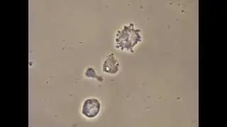 Bacteria attacking White Blood Cells