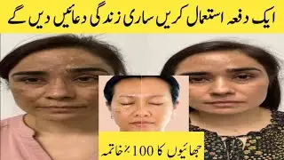 Melaplex Is A Great Night Cream For Bright & Even Skin Tone |Skin Whitening Cream