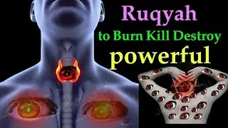 Helmy El Sayed Legal Ruqyah Against Evil Eye and Jealousy | Hafez Ali Irshad