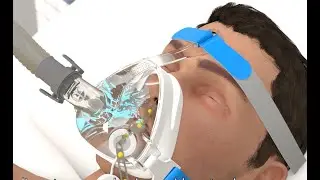 SVASTEK VAYU ALLTIP NIV Mask &ndash; Revolutionary Respiratory Technology