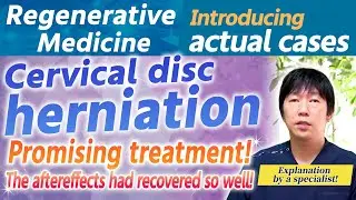 Doctor's Guide to Regenerative Medicine: New Cervical Disc Herniation Treatments! Don't Give Up!