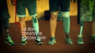 Trailer Amputation Ua