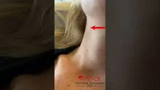 Jugular Venous Pulse: Arterial vs. Venous