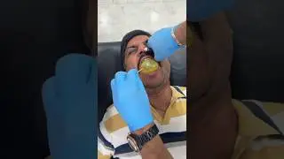 Balloon Therapy Solves 20 Years of Sinus Issues in Just 2 Sessions! #drravishinde #chiropractor