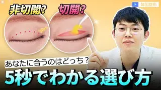 [Double Eyelid Surgery] A Korean Specialist Gives His Honest Opinion on the Pros and Cons of Inci...