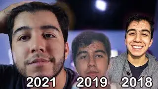MI EXPERIENCIA CON ACNE SEVERO ( experiencia, tratamiento y consejos) 🥺