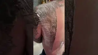 Satisfying Hair Removal Cream on VERY Hairy Back.