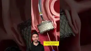 имплантация аортального клапана