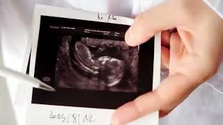 How Ultrasound Works (Sonography and Doppler Scans In Practice)