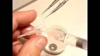 How To Fold Artificial Iris Implant into the Injector Brightocular