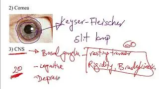 USMLE ACE Video 162: Wilson&rsquo;s disease