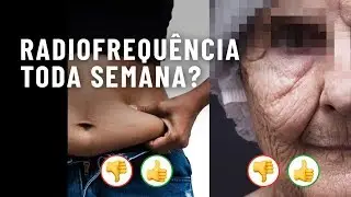 Posso aplicar RADIOFREQUÊNCIA toda semana?