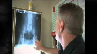 Chiropractor Walnut Creek