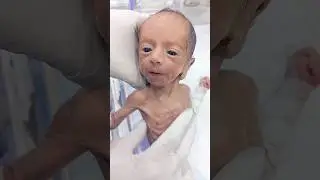 &ldquo;Cute Preetiram Baby | 8-Month, 1kg & Doing Well in NICU&rdquo;#newbornbaby #neonatologist #hospital #baby