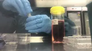 How to count cells in tissue culture ( including steps, dilution factor and calculation)