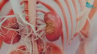 Hydronephrosis in Children: Diagnosis & Treatment Explained | Dr. Balamourougane P |