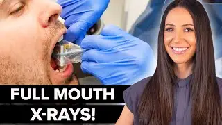 Dental Hygienist Explains Full Mouth Dental X-Ray (FMX)