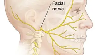 Medical surgical nursing topic - Bell's palsy👨1st part