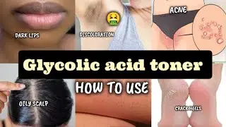 STOP Using Glycolic Acid Like This (Dark Areas Warning)