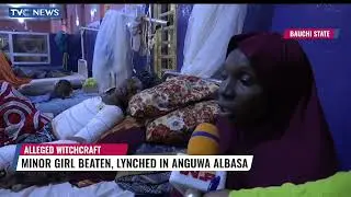 Minor Girl Beaten, Set Ablaze In Anguwa Albasa Over Alleged Witchcraft