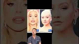 Christina Aguilera&rsquo;s Jaw-Dropping Transformation Explained! 😍 | Dr Julian De Silva
