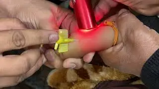 Vein Finder Cannulation Technique in Baby / Neonate&rdquo; 👶💉