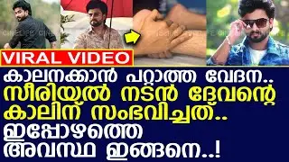 സീരിയല്‍ നടന്‍ ദേവന്റെ കാലിന് സംഭവിച്ചത്..!! l Deva Dev