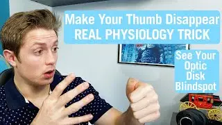 Everyone Has a Blind Spot in Their Vision | 20th Week in Medical School