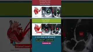 Normal and Heart failure Echo #echo #shorts