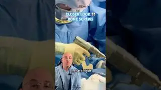 How Many Bone Screws In Your Body⁉️