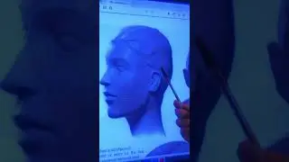 INTERET OU PAS DE LA POSE DES FILS TENSEURS DANS LE VISAGE ?