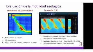 EndoFLIP,  &iquest;Qu&eacute; es?  &iquest;Para qu&eacute; sirve en 2024? Dr Luis F Pineda
