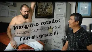 Manguito rotador.