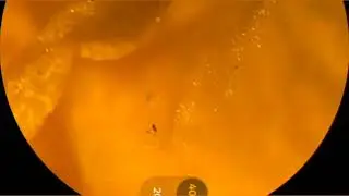 Microscope video @harkeshsaini5.0