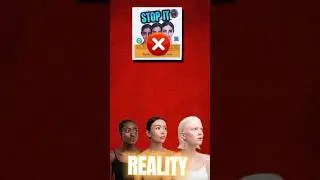Jiore Snich Soap For Skin Whitening #skinwhitening #ytshorts #shortsfeed
