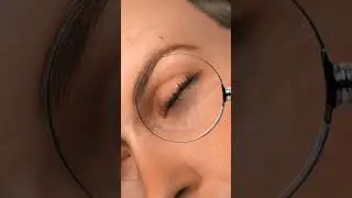 How mid facelift surgery works
