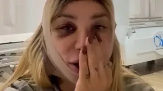 VLOG: FIZ MAIS UM PROCEDIMENTO ESTÉTICO + UM DIA COMIGO E AMIGOS.❤️ REALITY DA MAYA MASSAFERA.