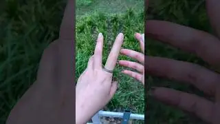 This Prosthetic Finger Looks So Real 💎