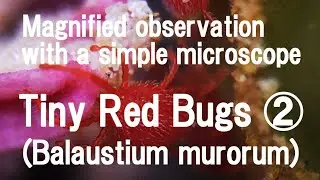 Magnified observation with a simple microscope: Tiny Red Bugs(Balaustium murorum)2