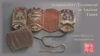 Acupuncture Treatment in Ancient Times