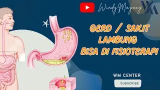 Part 2 .. sakit lambung / gerd bisa fisio