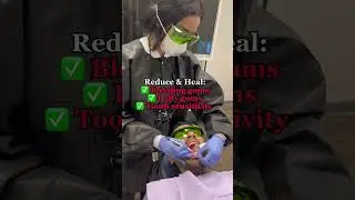 Laser Treatment Experience💥