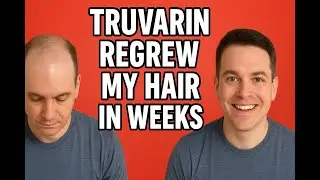 How TruVarin Helped Me Regrow My Hair (Fast Results!)