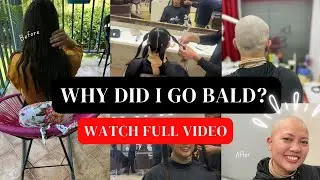 Why did I go bald? Watch full video | Part 1 Answering all the “whys”