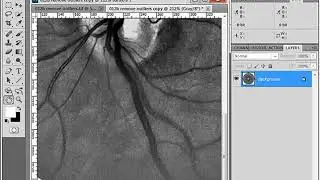 021 Noise Reduce Image Size Method