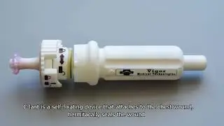 Our Success Stories: Vigor Medical - C-CLANT