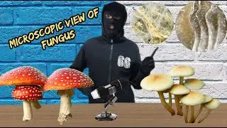 Observing the anatomy of the fungus under the microscope.