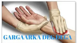 Buuga gargaarka deg-dega casharka 1-Aad