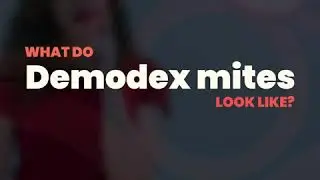 demodex look like